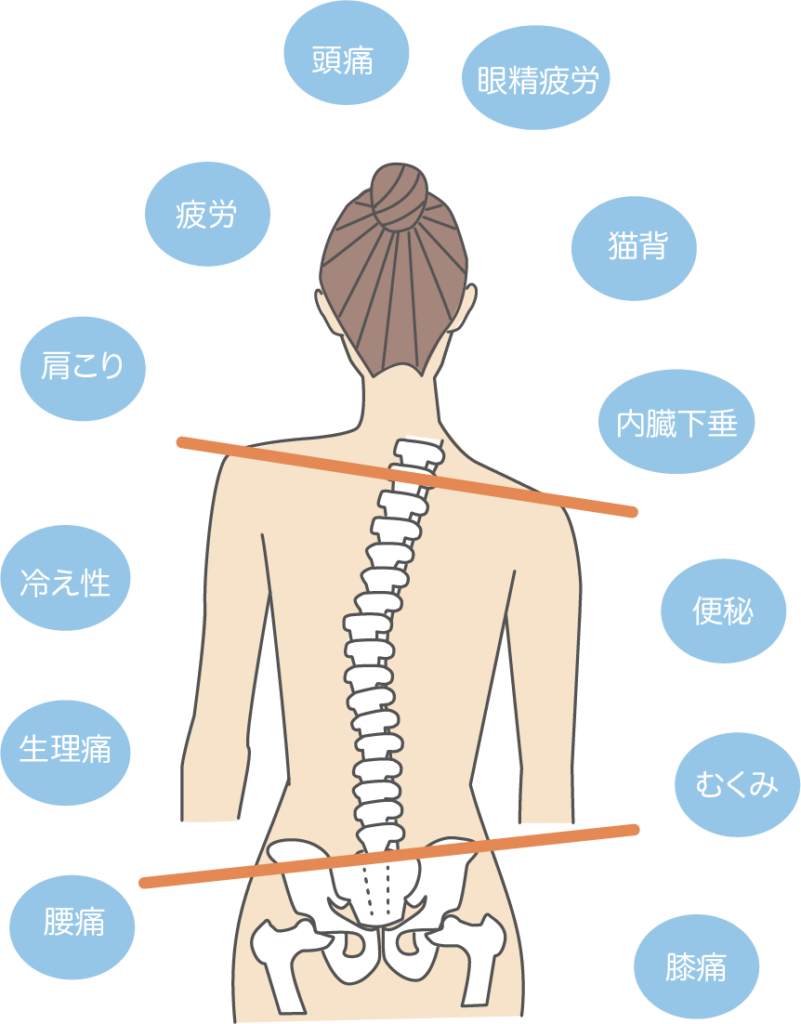 骨盤調整　骨盤矯正　骨盤のゆがみ　体調不良